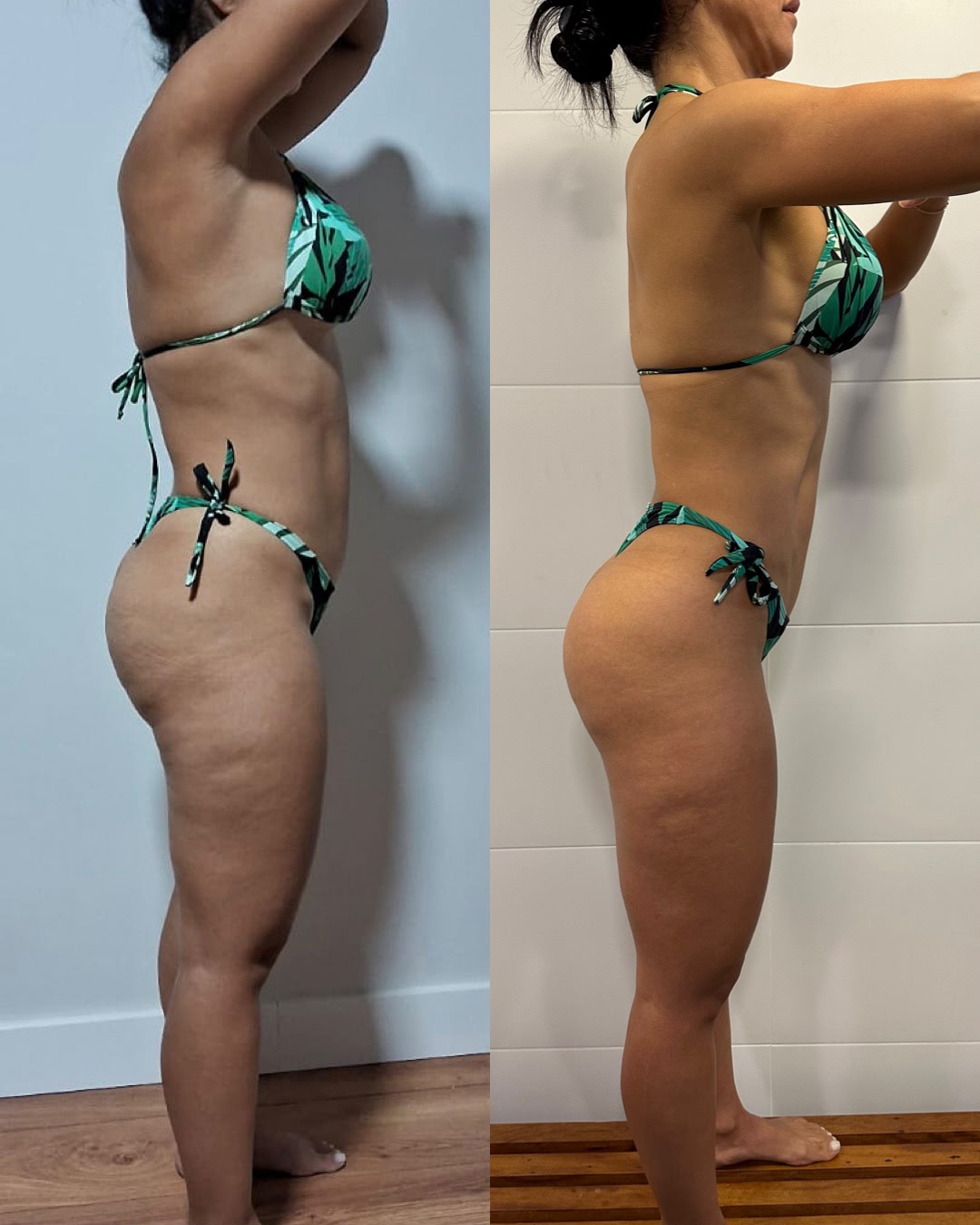 Transformação de Fabiana: antes e depois