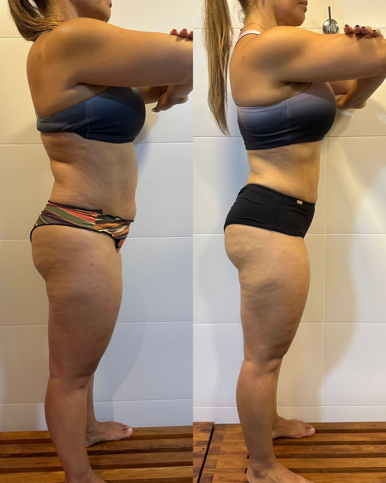 Transformação de Susana: antes e depois